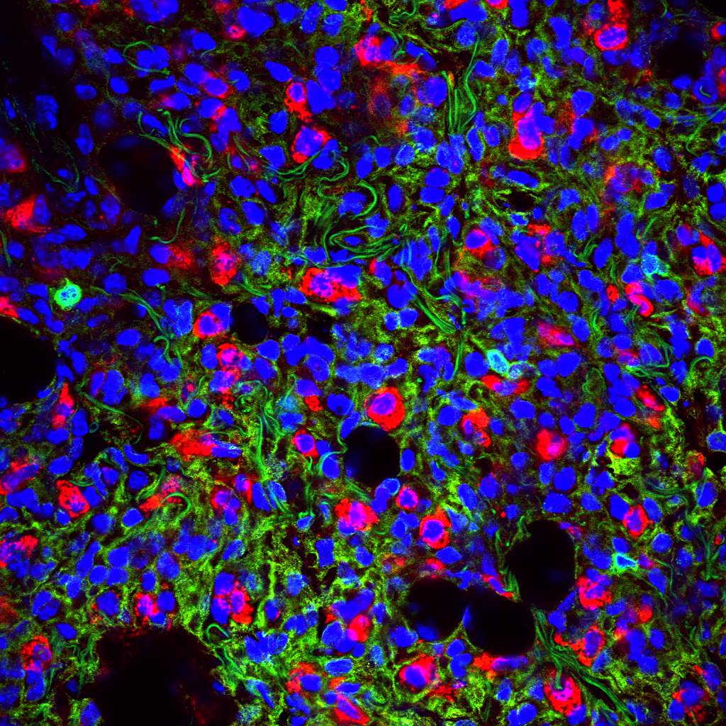 In vivo biotinylated lung vasculature: biotin: red, CD31: green, DAPI: blue (credit: Rasmus Enno)
